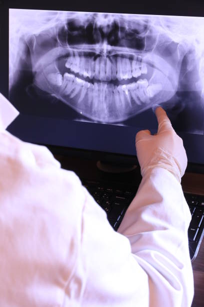 Best Emergency Broken Tooth Repair in Meron Park, CA